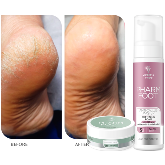 PHARM FOOT ANTI CALLUS MASTER- SOFTENING FOAM 200ML - Victoria Vynn