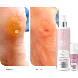 PHARM FOOT SEPTI STARTER – REFRESHING SPRAY 300ML - Victoria Vynn
