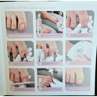 Pharm Foot brosjyre reconstructor Engelsk